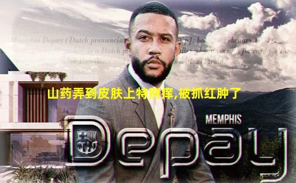 山药弄到皮肤上特别痒,被抓红肿了